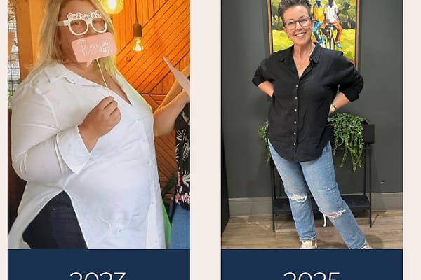 Marcelle, before and after her bariatric surgery journey, dated 2023 and 2025.